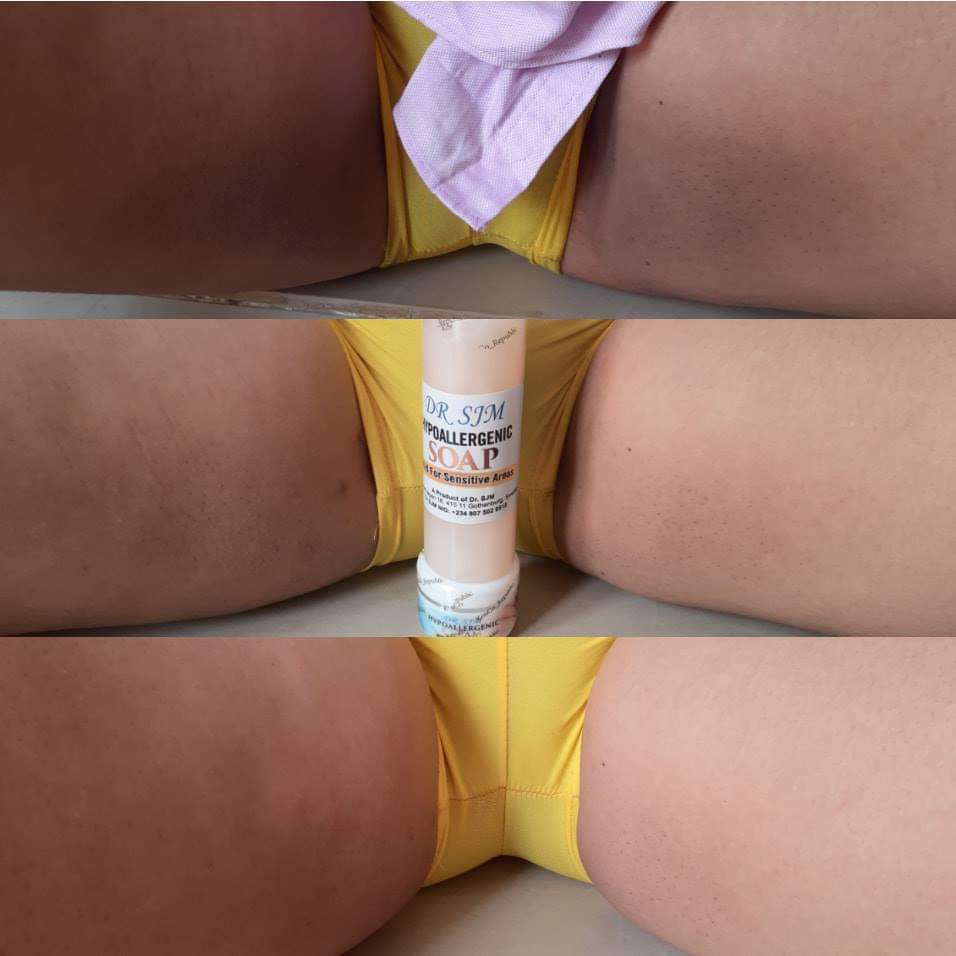 Dr SJM's Hypoallergenic Kit/set